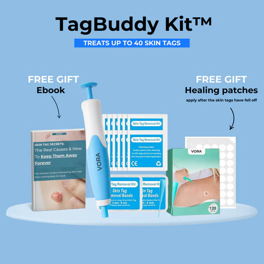 TagBuddy-kit™ No More Skin Tags